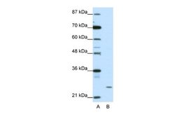 ZNF253 Antibody, Novus Biologicals 100 &mu;L | Buy Online | Novus Biologicals | Fisher Scientific